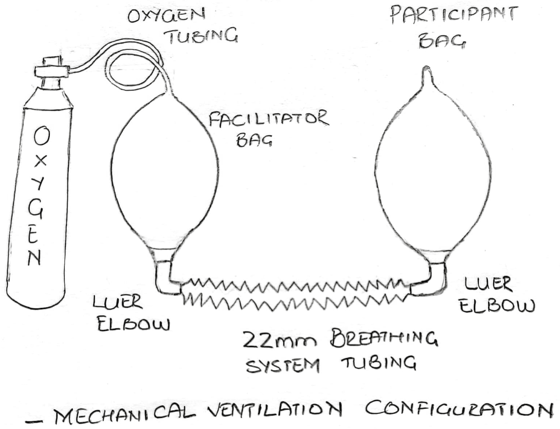 Schematic representation of the mechanical ventilation configuration