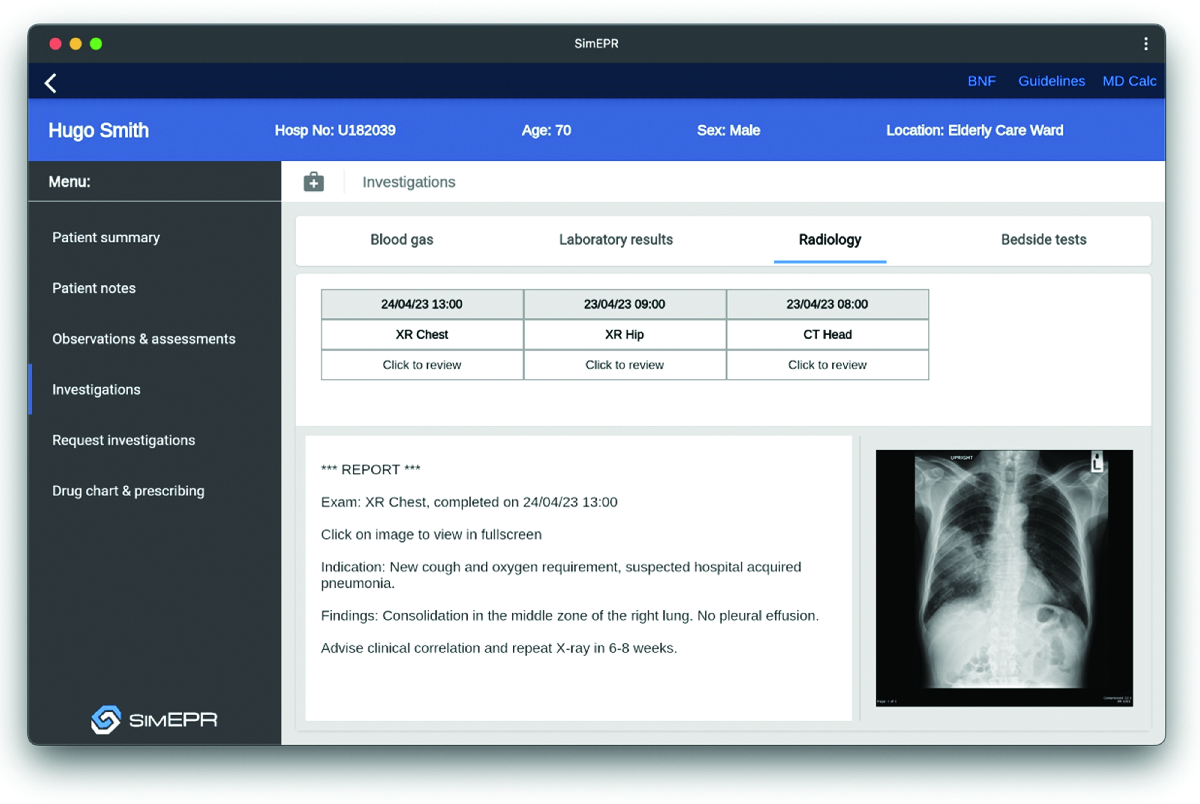 A preview of SimEPR, a novel educational electronic patient record system designed for UK medical simulation training